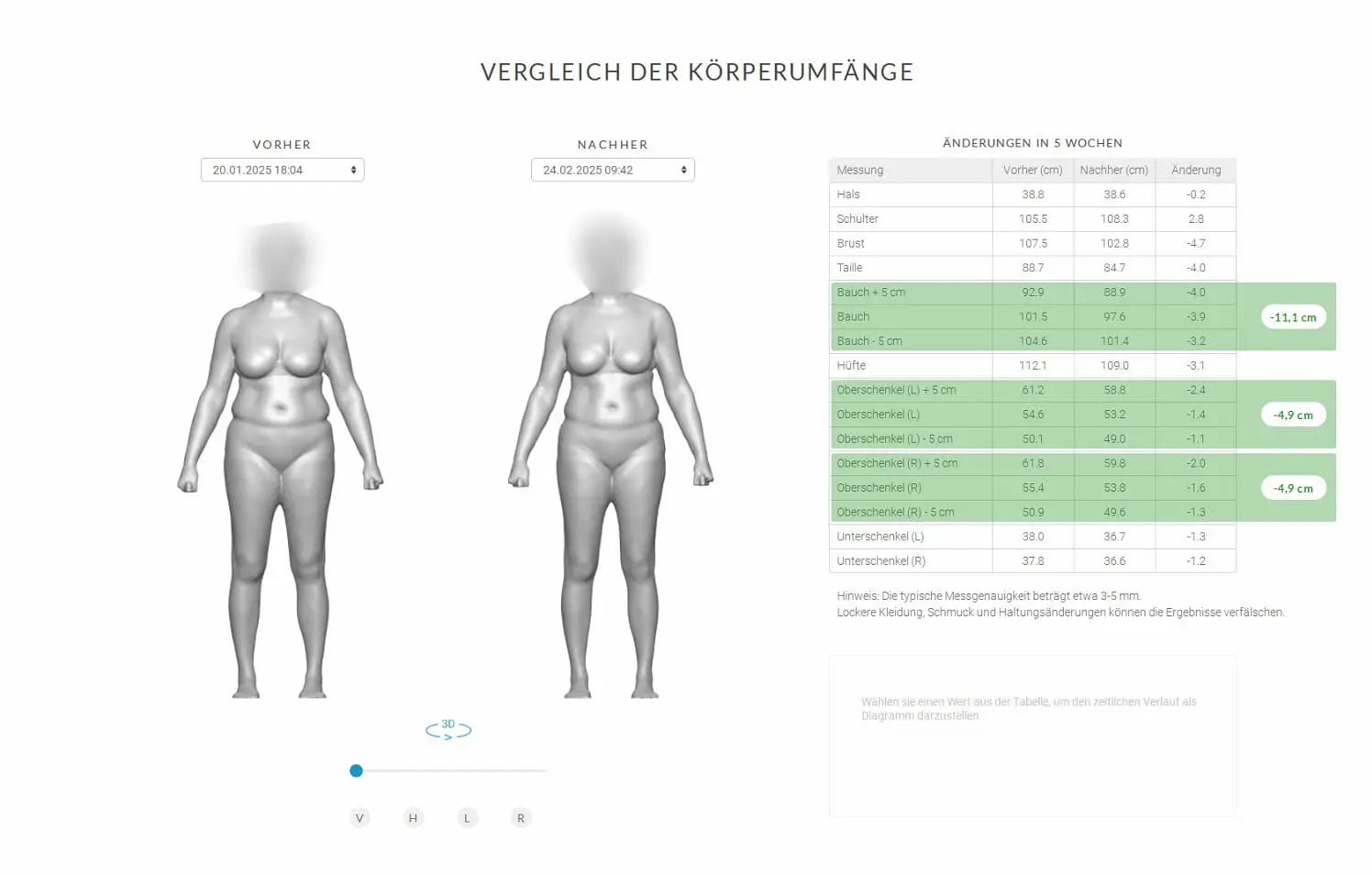 Anonymisierter SCANECA-Vergleich zweier Messzeitpunkte